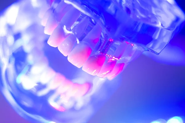 Denti dentali modello ortodontico — Foto Stock