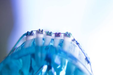 Diş diş köşeli metal