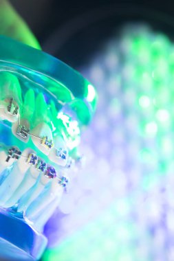 Diş diş köşeli metal