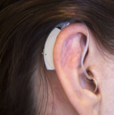 Kulakta işitme cihazı