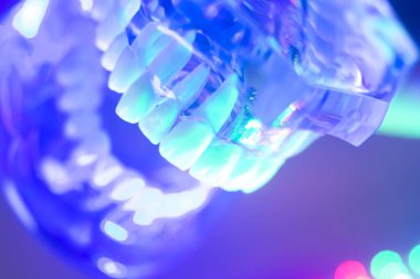 Ortodontik diş diş modeli