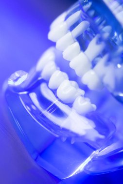 Diş hizalama diş modeli