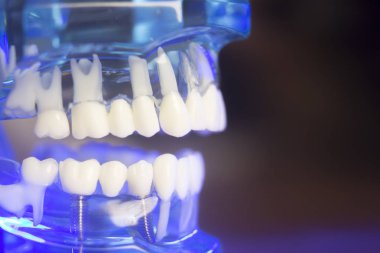 Diş diş klinik modeli