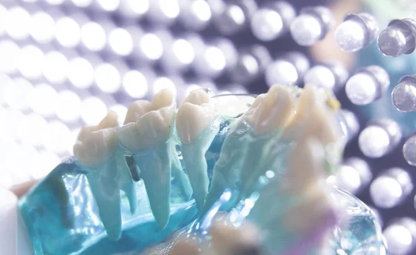 Zamki metalowe zębów dentystycznych — Zdjęcie stockowe