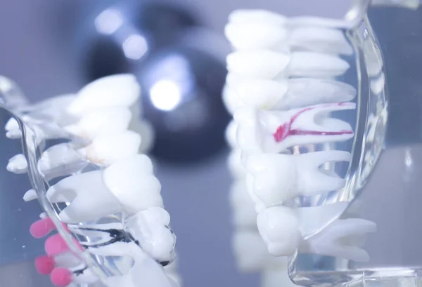 Modelu jamy ustnej zębów dentystycznych — Zdjęcie stockowe