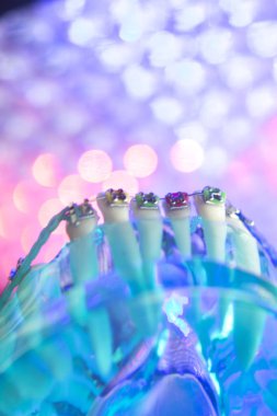 Diş diş köşeli metal