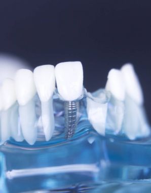 Dentsts diş diş modeli