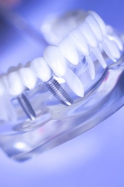 Diş diş ağız modeli