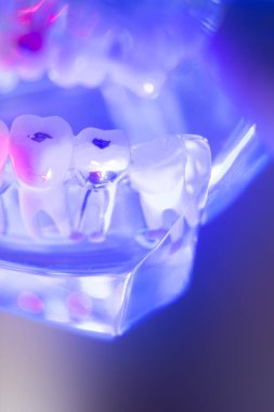 Diş sağlıklı diş modeli