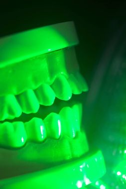 Diş diş çene modeli