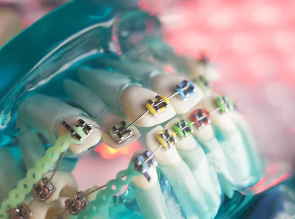 Diş diş köşeli metal