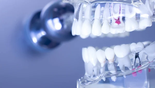 Модель рота зубів зубів — стокове фото
