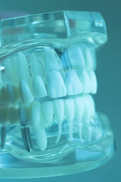 Dental teeth mouth model