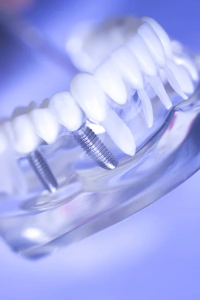 Dental teeth mouth model — Stock Photo, Image
