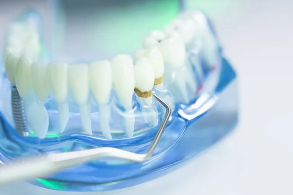 Modello di dentista dentale — Foto Stock