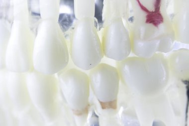 Diş diş kök kanal