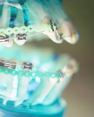 Diş diş köşeli metal