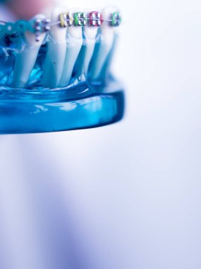 Diş diş köşeli metal