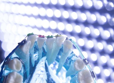 Diş diş köşeli metal