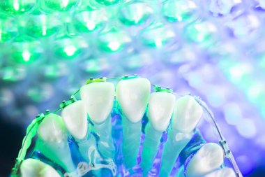 Diş diş köşeli metal