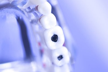 Diş diş ağız modeli