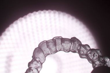 Görünmez diş aligner köşeli ayraç