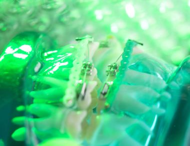 Diş diş köşeli metal