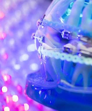 Diş diş köşeli metal