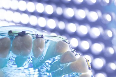 Diş diş köşeli metal