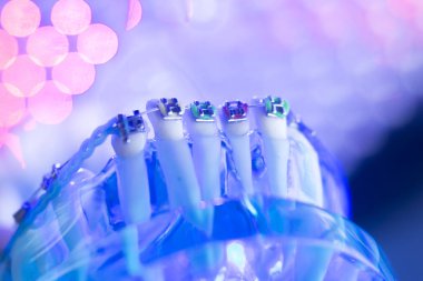 Diş diş köşeli metal