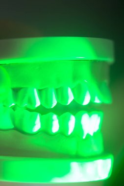 Diş diş çene modeli