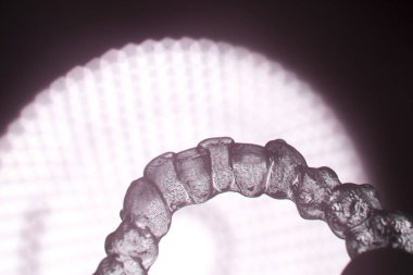 Görünmez diş aligner köşeli ayraç