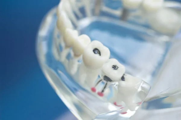 Dental teeth mouth model