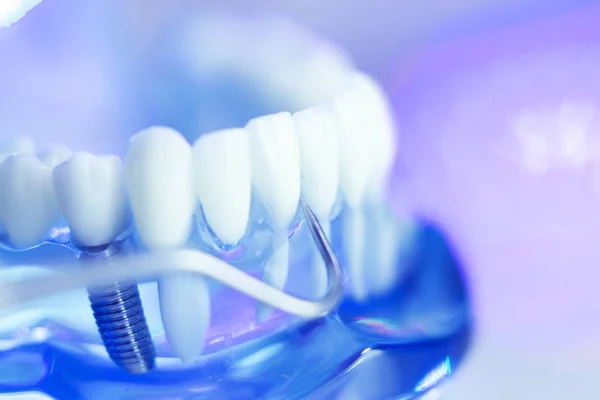 Zębów dentystycznych dentysta modelu — Zdjęcie stockowe