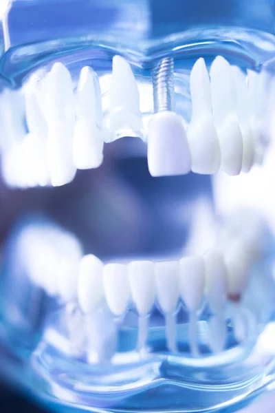 Dentisti modello dentale — Foto Stock