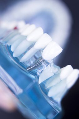 Dentsts diş diş modeli