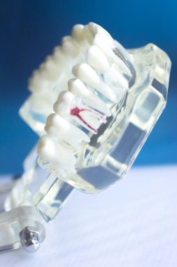 Diş diş ağız modeli