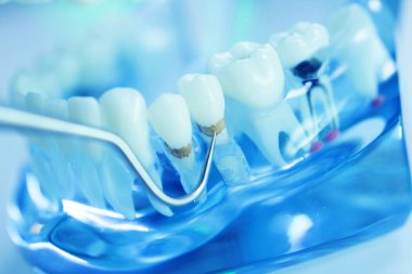 Diş diş dişçi modeli