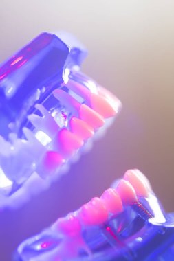 Diş sağlıklı diş modeli