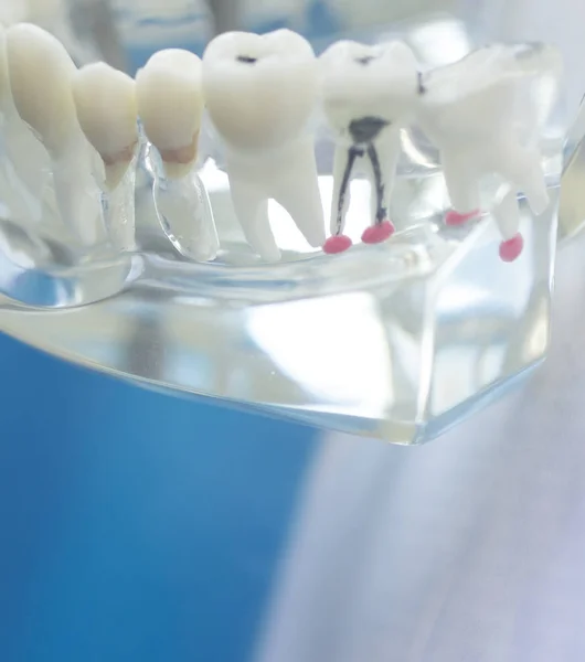 Modelo de boca de dientes dentales — Foto de Stock