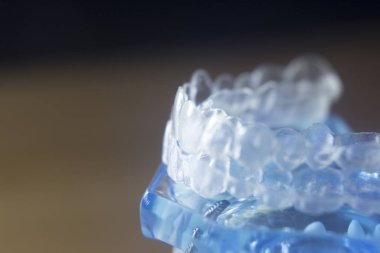 Diş diş bracets modeli