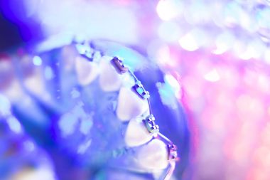 Diş diş köşeli metal