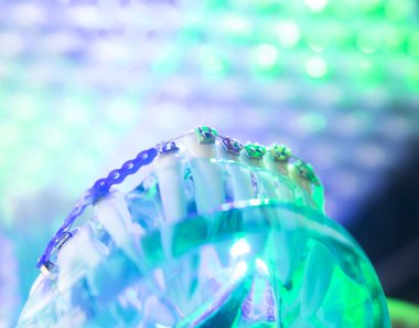 Diş diş köşeli metal