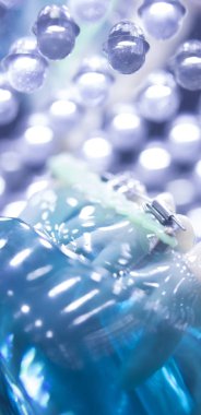 Diş diş köşeli metal