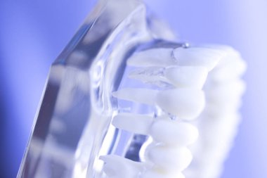 Diş diş ağız modeli