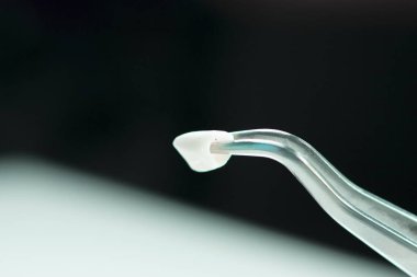 Diş diş diş modeli