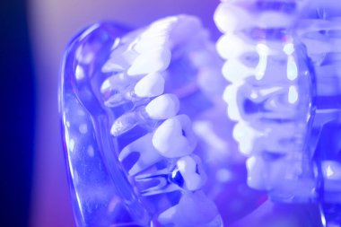 Diş sağlıklı diş modeli