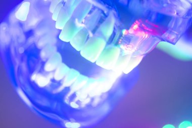 Ortodontik diş diş modeli