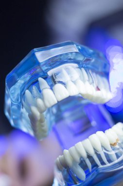 Diş diş ağız sağlığı