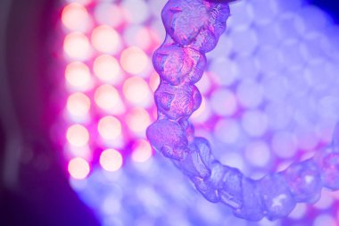 Görünmez diş aligners parantez